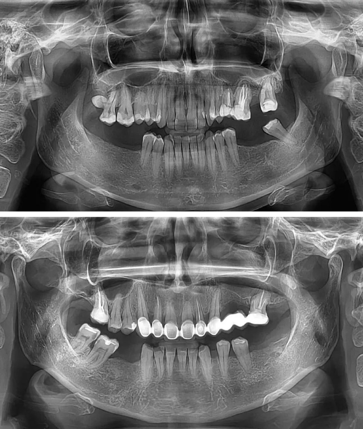 no-margin Digitalni-ortopan-snimak
