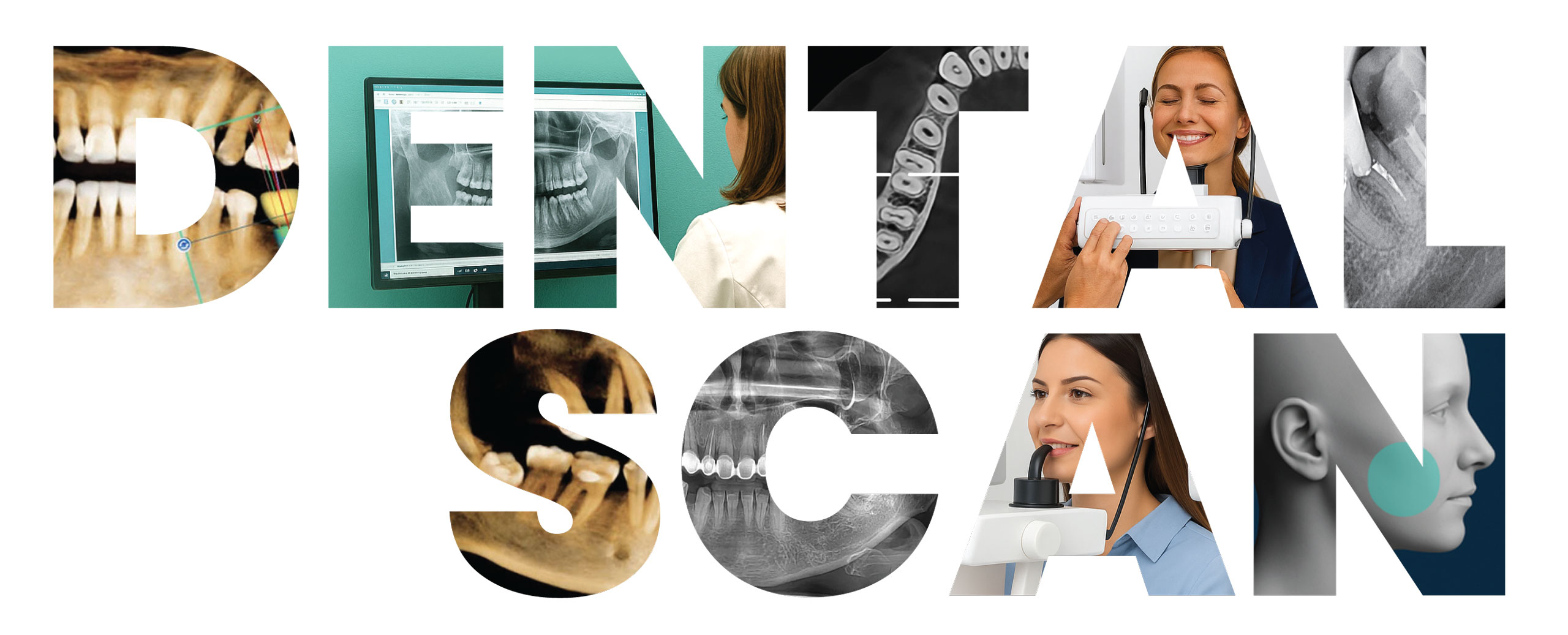 Snimanje zuba i vilica Beograd - Dental scan 