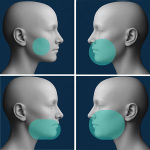 3d snimanje zuba u različitim veličinama snimka