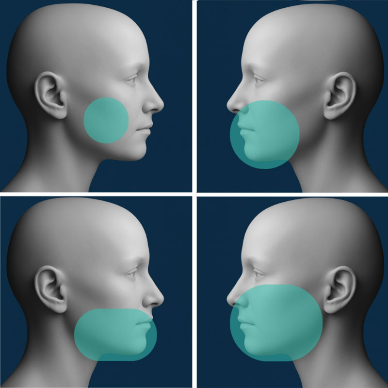 3d snimanje zuba u različitim veličinama snimka