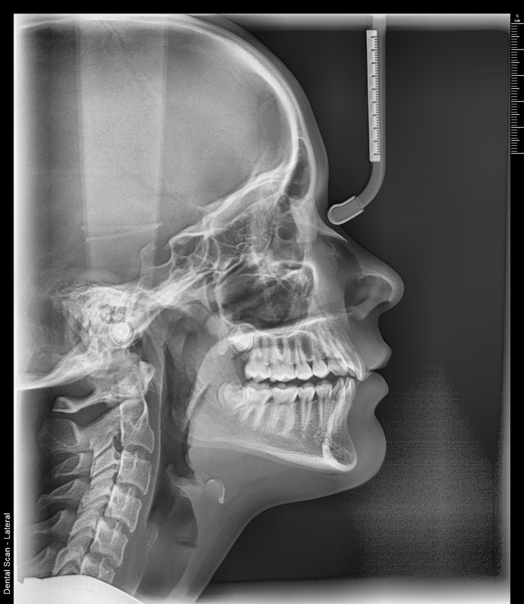 Telerendgen snimak profila glave