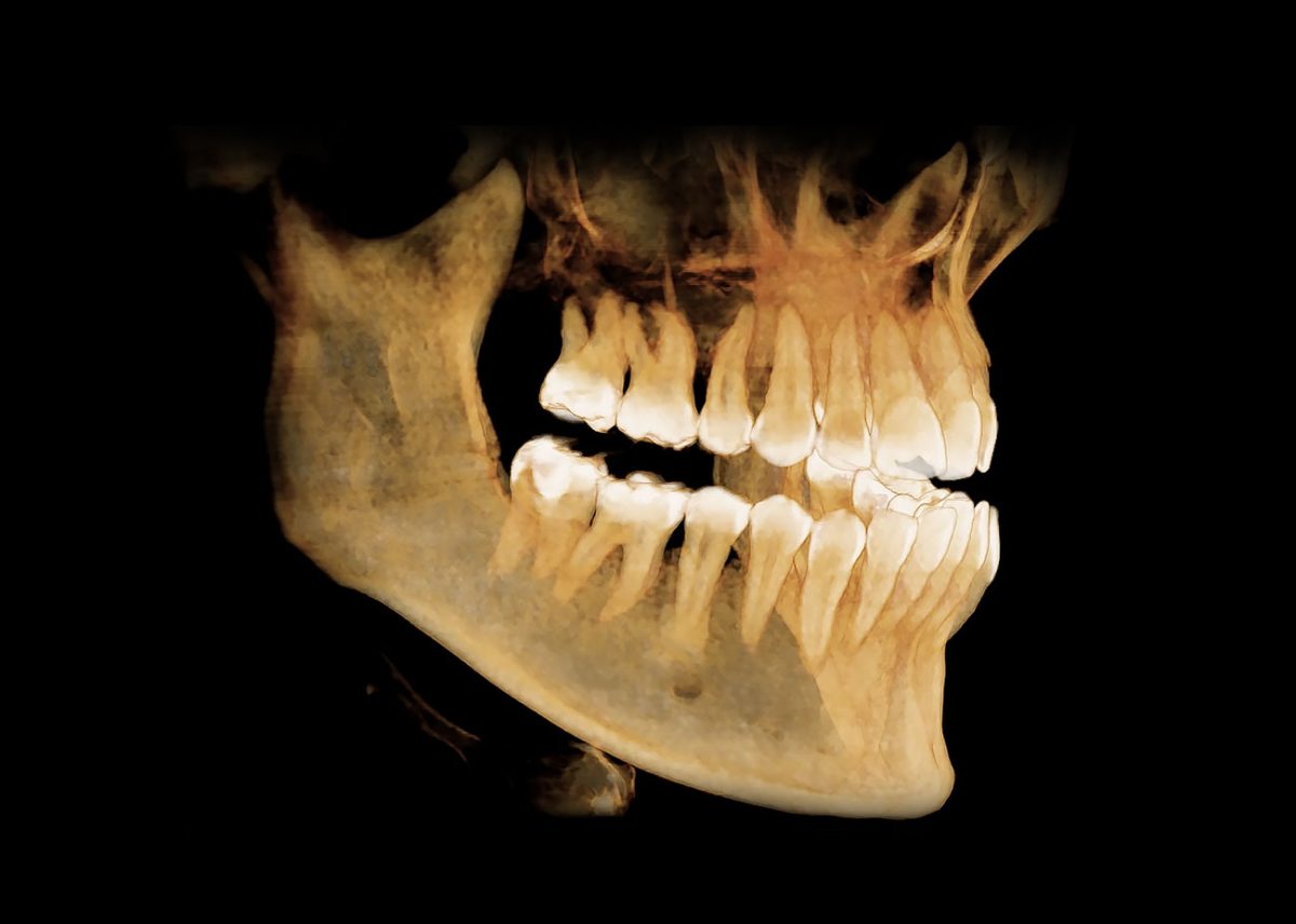 cbct-3d-standard-snimanje-obe-vilice