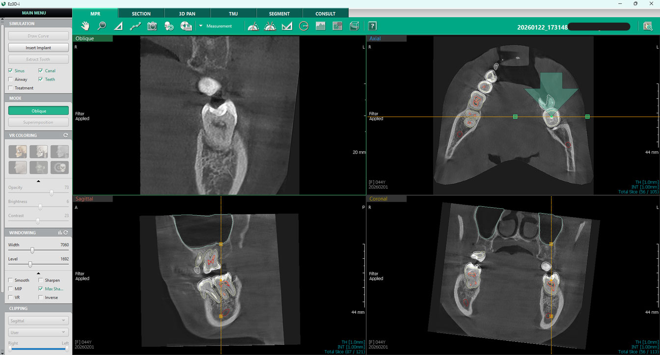 Vodic-za-analizu-CBCT-snimaka-360