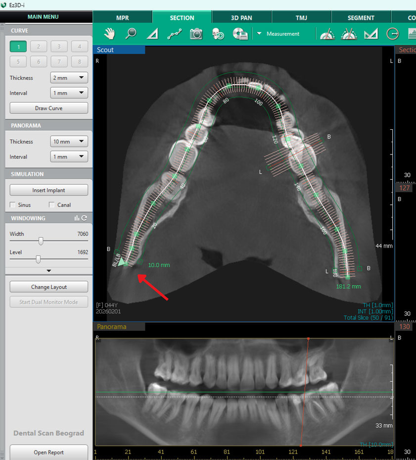Vodic-za-analizu-CBCT-snimaka-SECTION-korekcija