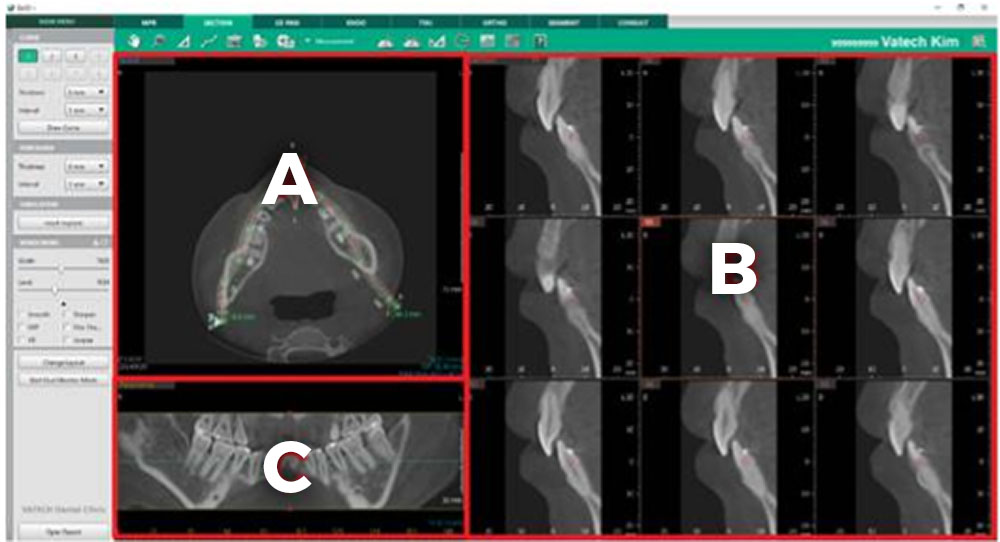 Vodič za analizu CBCT snimaka