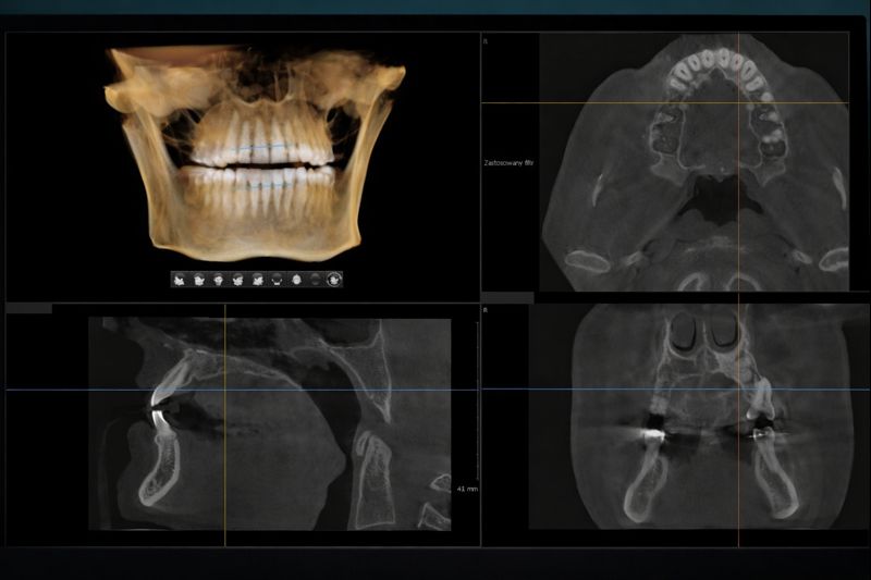 3d snimak zuba prikaz u više racvni