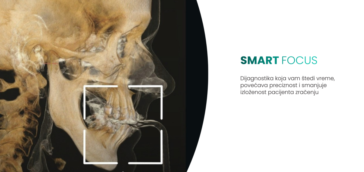 3d snimanje zuba Beograd