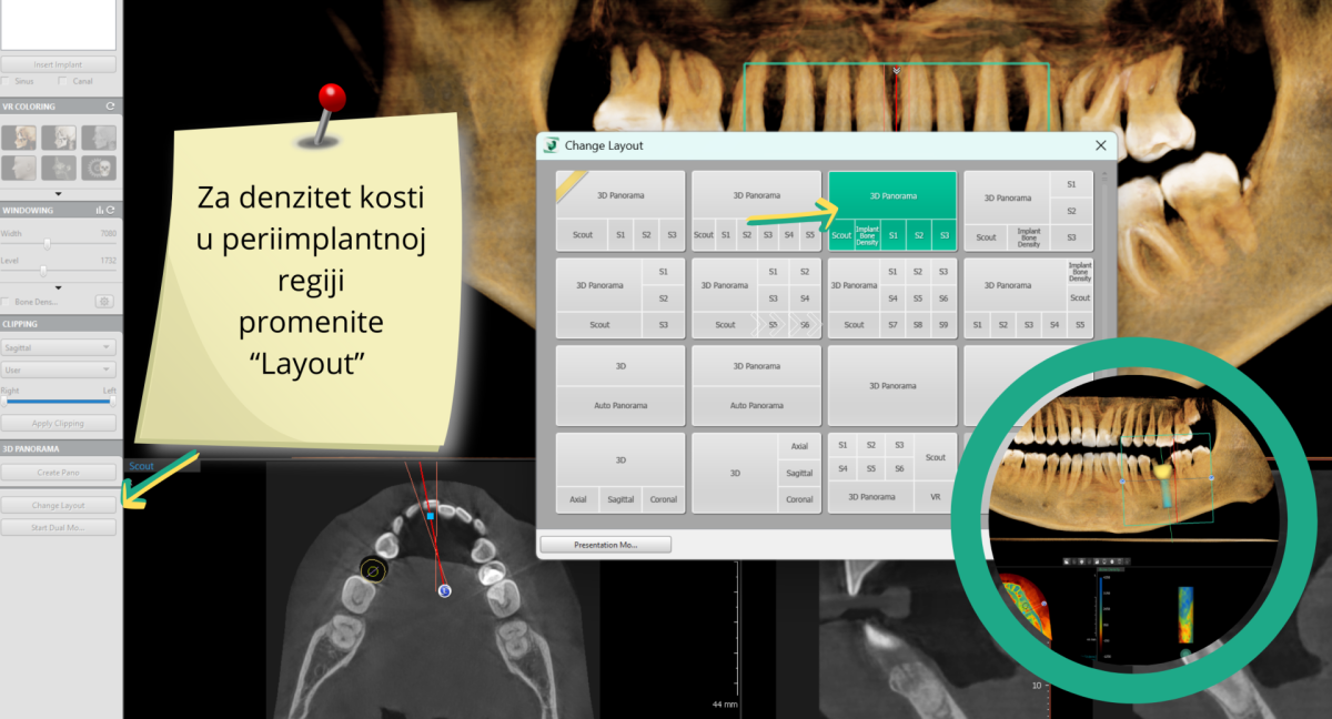 Smernice za rad u programu za analizu cbct snimka, Dental Scan centar za 3D snimanje zuba