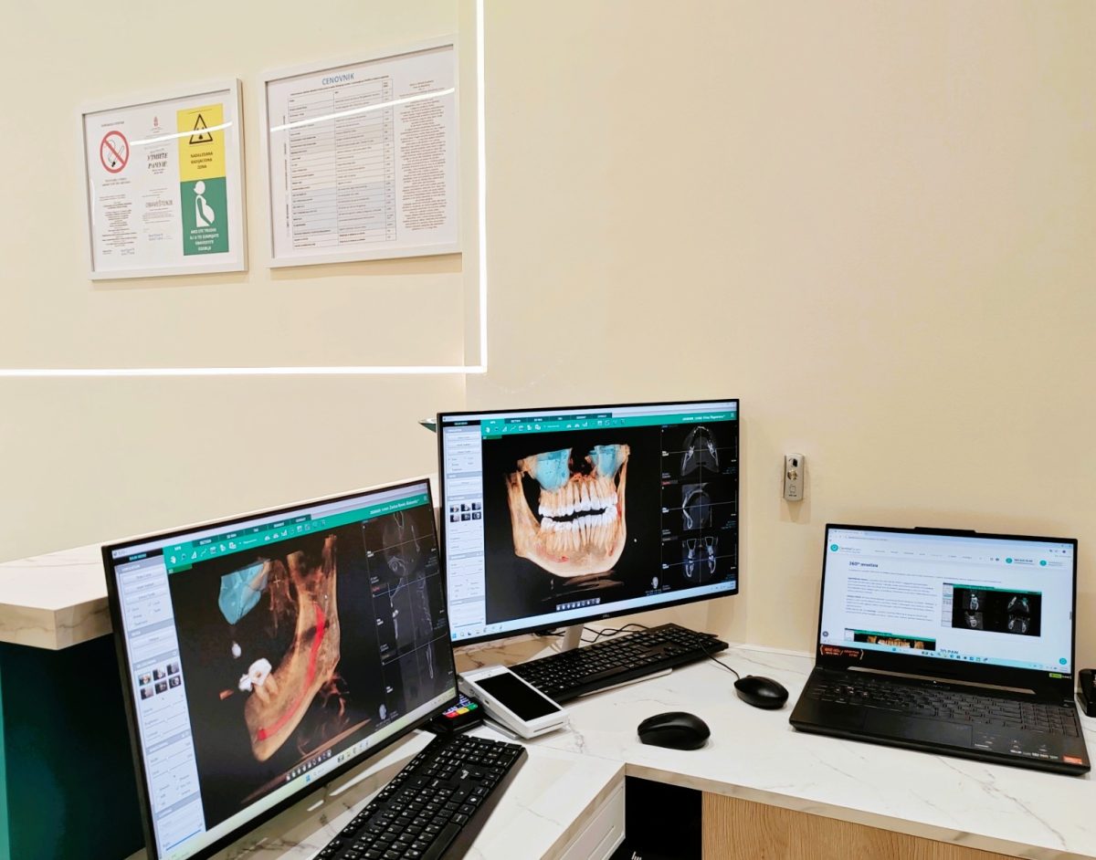 Radne jedince za obradu cbct snimaka u Dental Scan-u