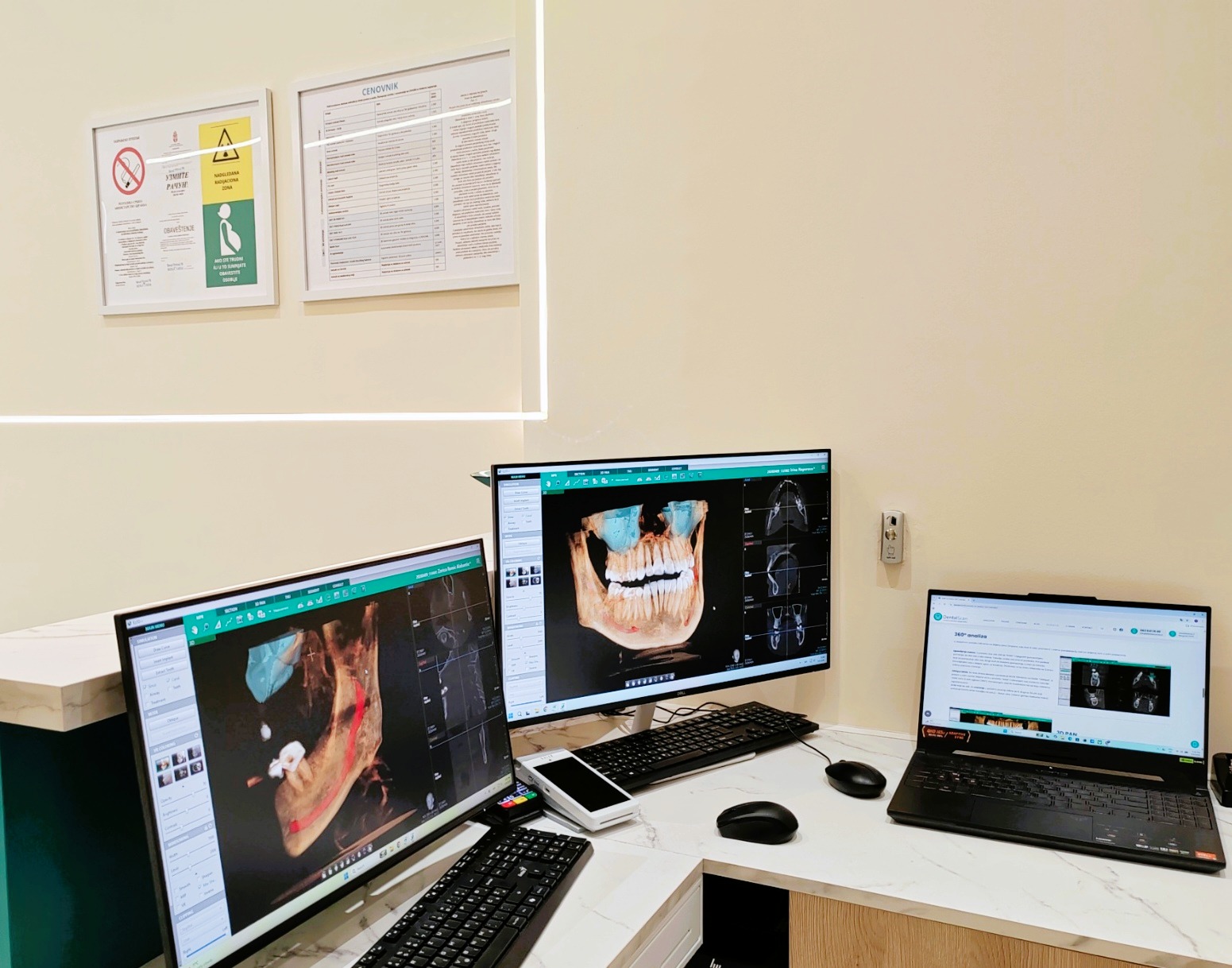 Radne jedinice za obradu 3D CBCT snimaka u Dental Scan centru