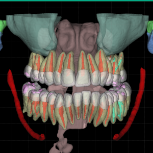 3d snimak i AI obrada